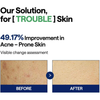 MEDIHEAL Teatree Trouble Pad